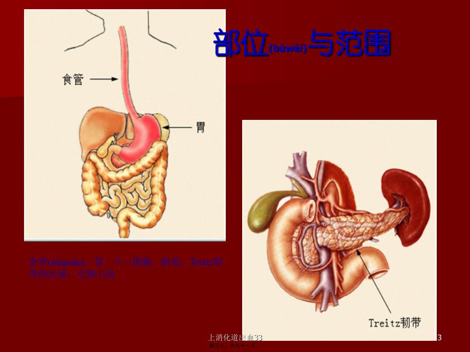 上消化道出血33课件_第3页