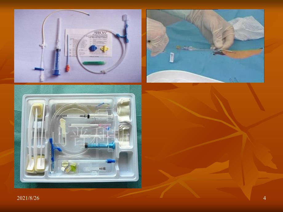 锁骨下静脉穿刺置管术课件PPT_第4页