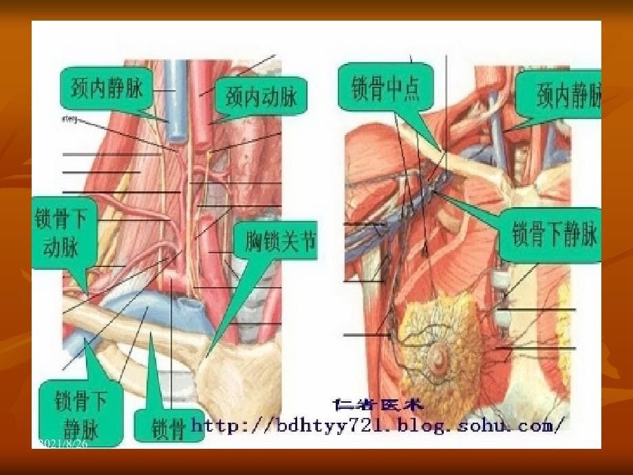 锁骨下静脉穿刺置管术课件PPT_第5页