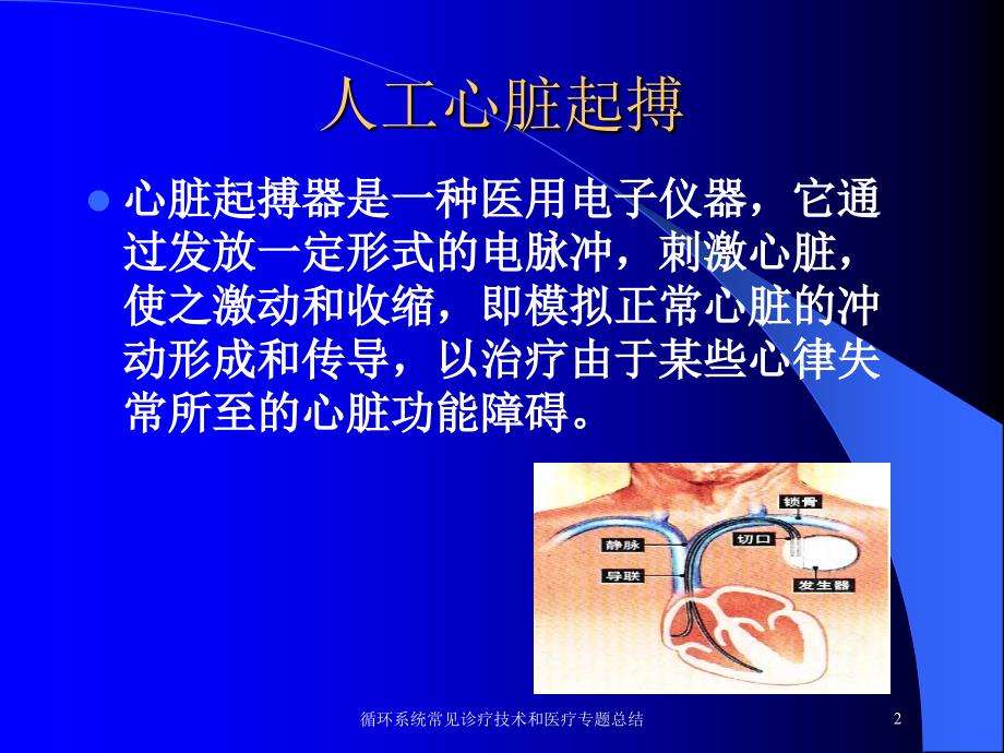 循环系统常见诊疗技术和医疗专题总结培训课件_第2页