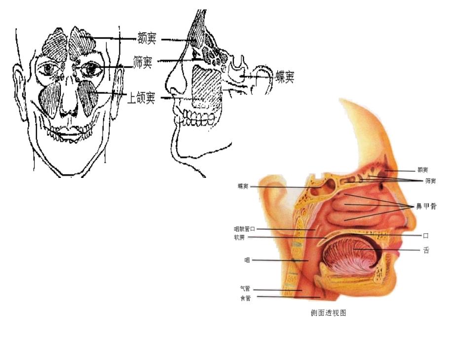 儿科呼吸系统疾病诊疗及护理进展PPT课件_第4页