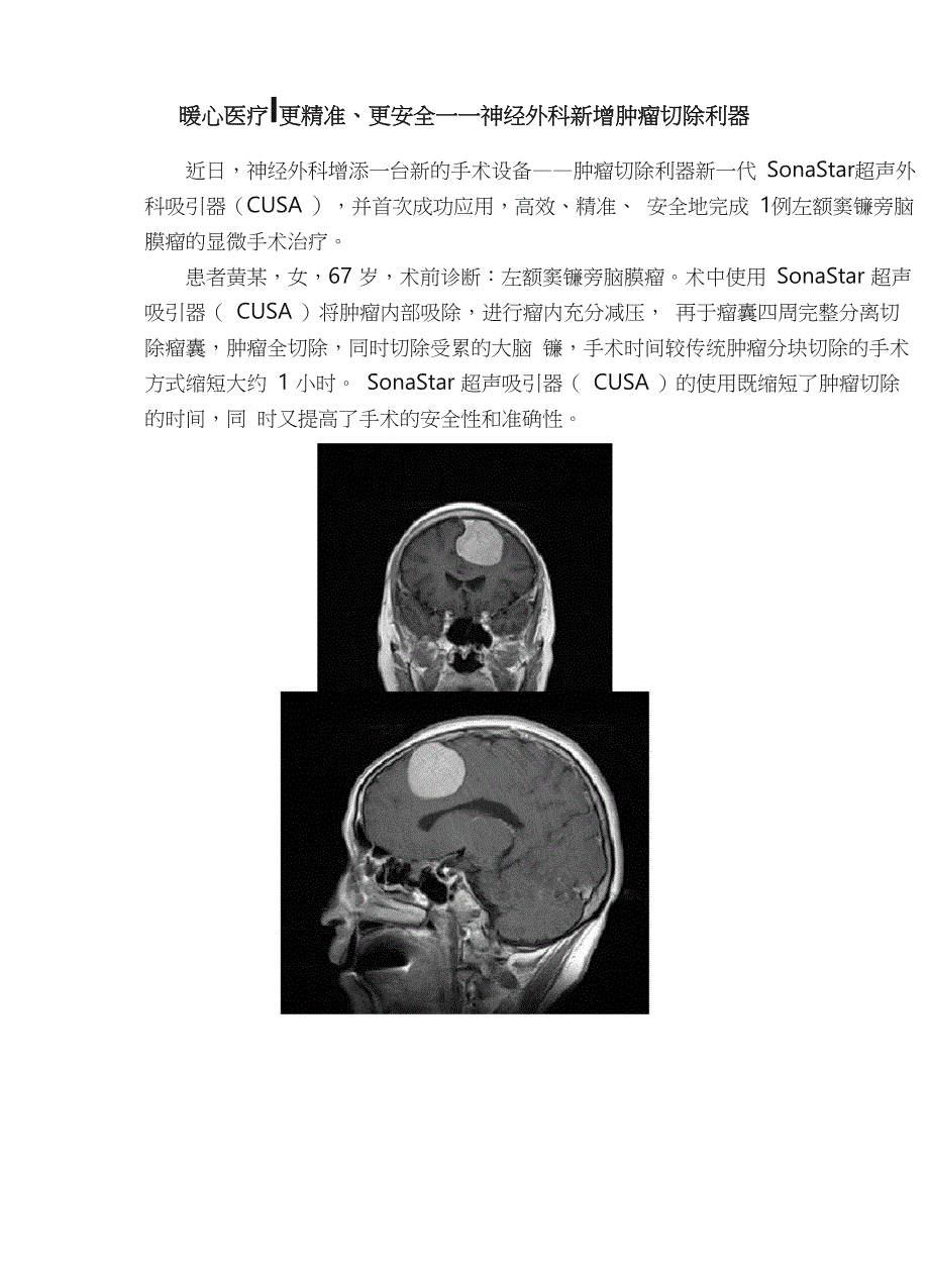 暖心医疗｜更精准、更安全_第1页