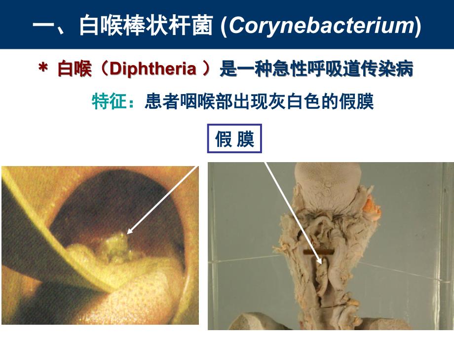 《其他细菌》PPT课件_第3页