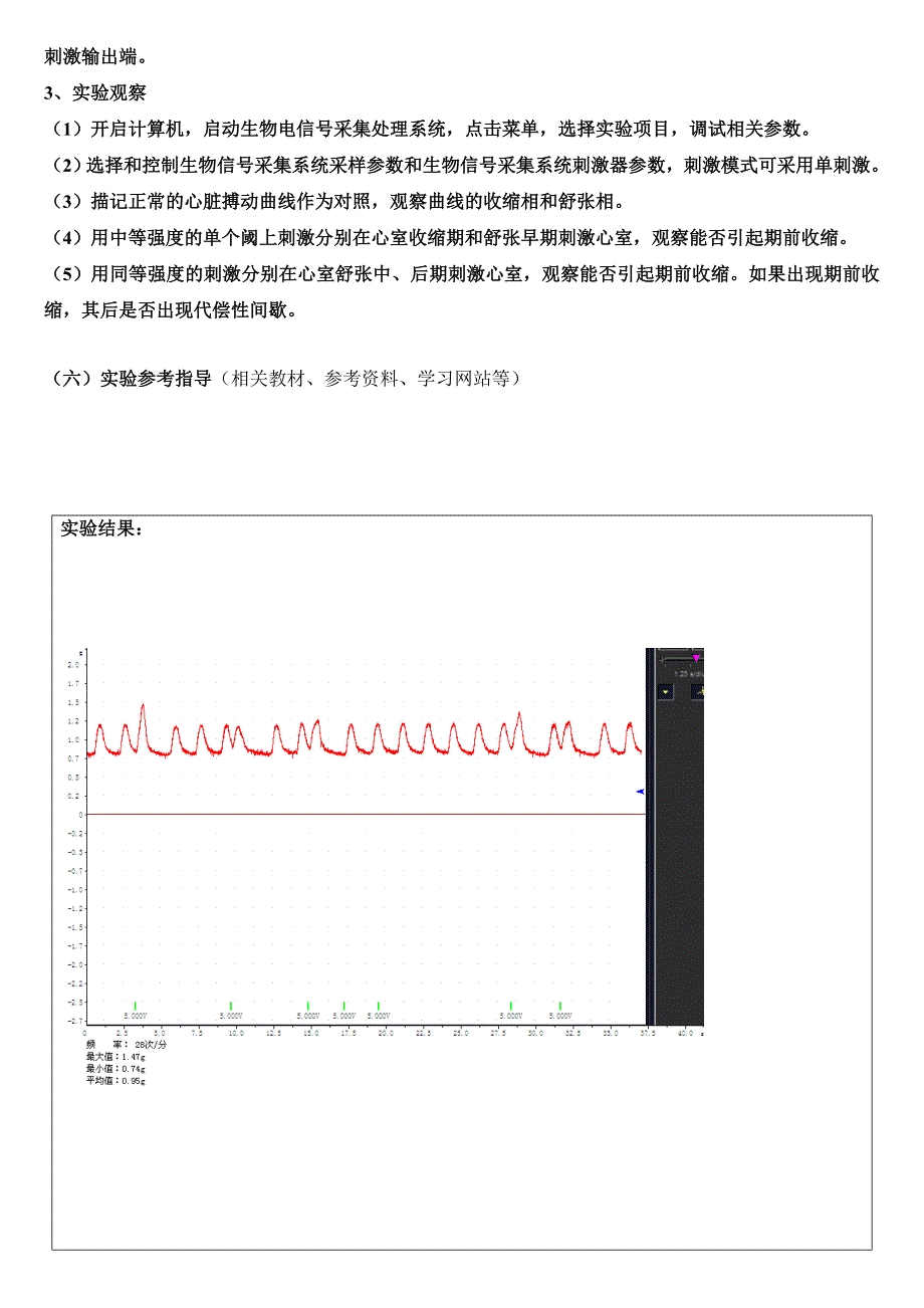 青蛙期前收缩与代偿性间歇实验报告_第2页