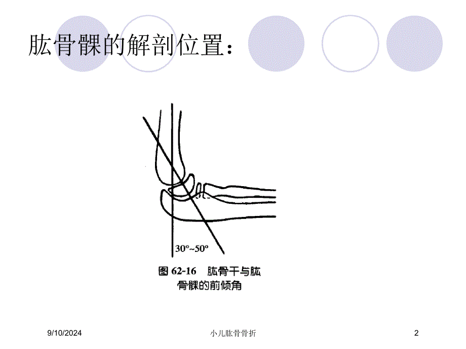 小儿肱骨骨折课件_第2页