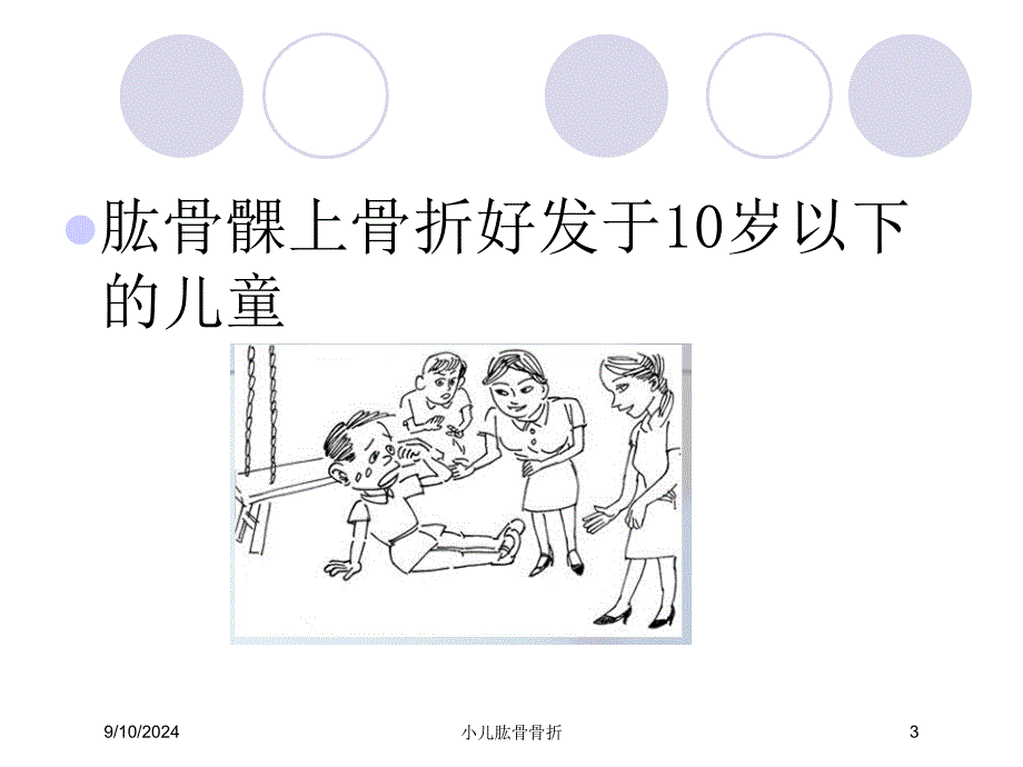 小儿肱骨骨折课件_第3页