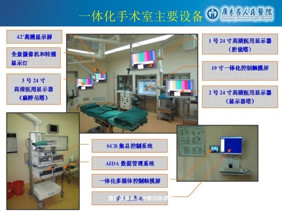 腹腔镜胰体尾肿瘤切除课件_第5页