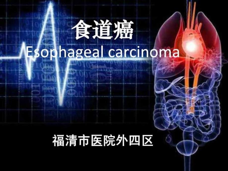 《食管癌护理查房》PPT课件_第2页