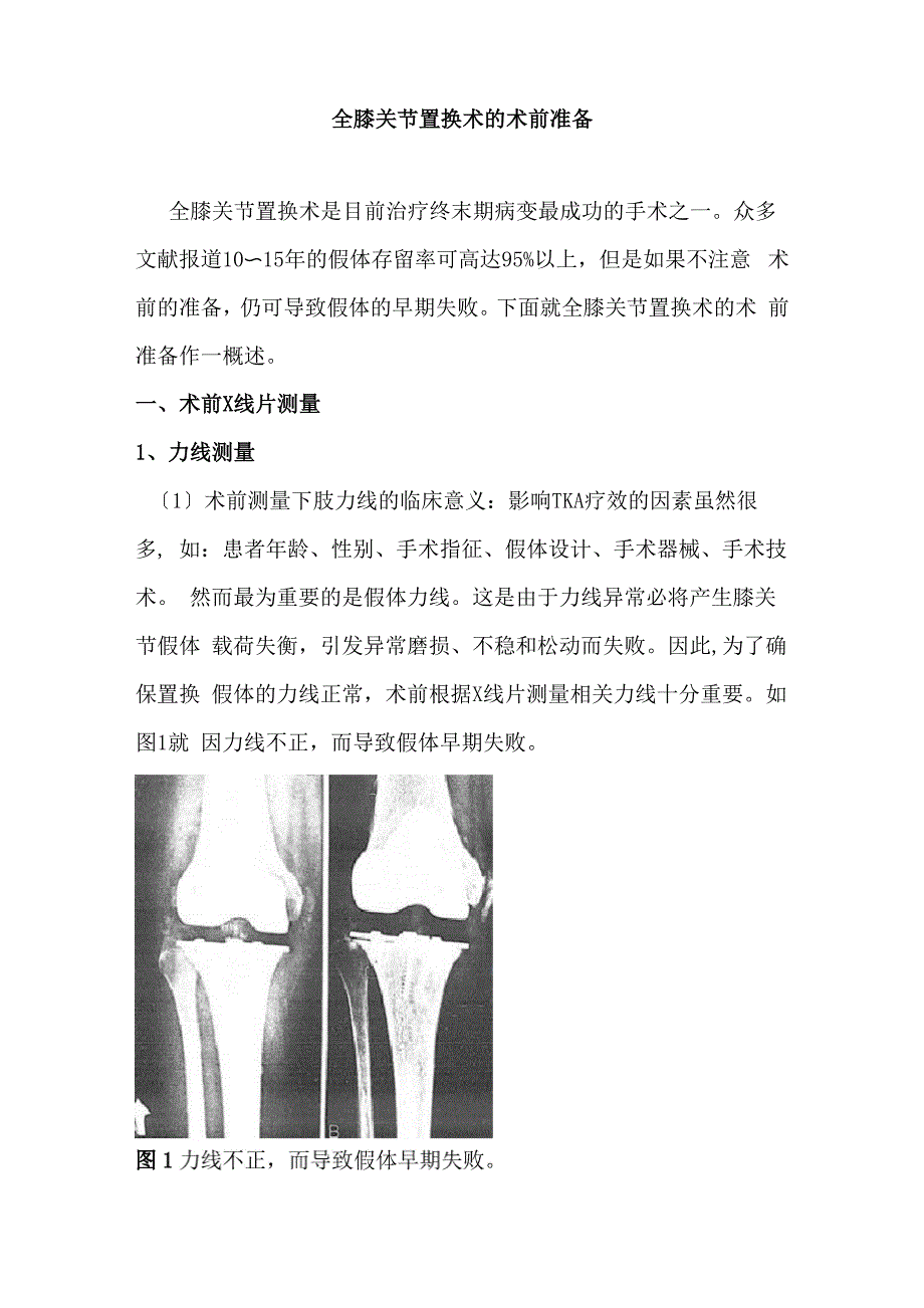 全膝关节置换术的术前准备修改_第1页