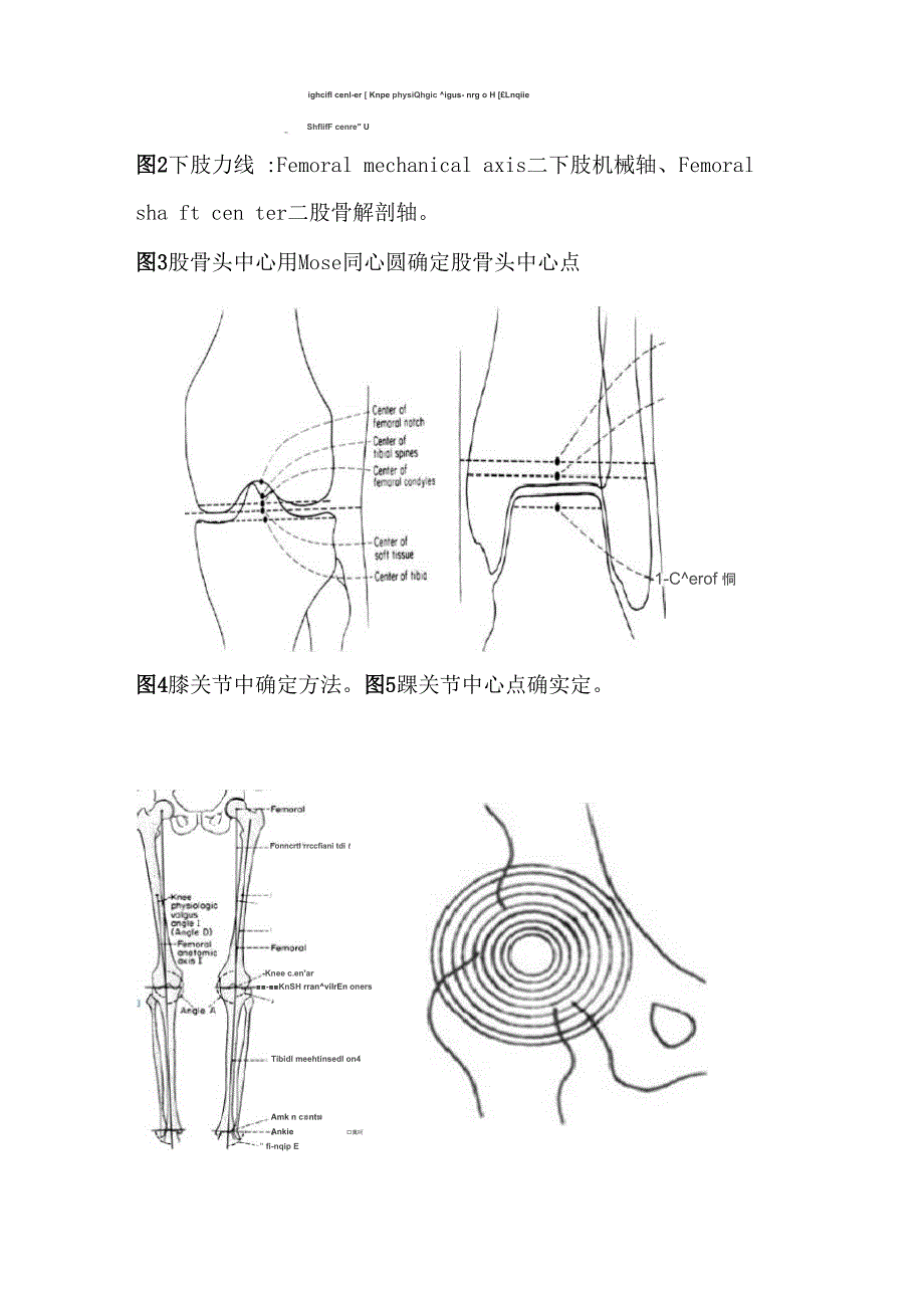 全膝关节置换术的术前准备修改_第3页