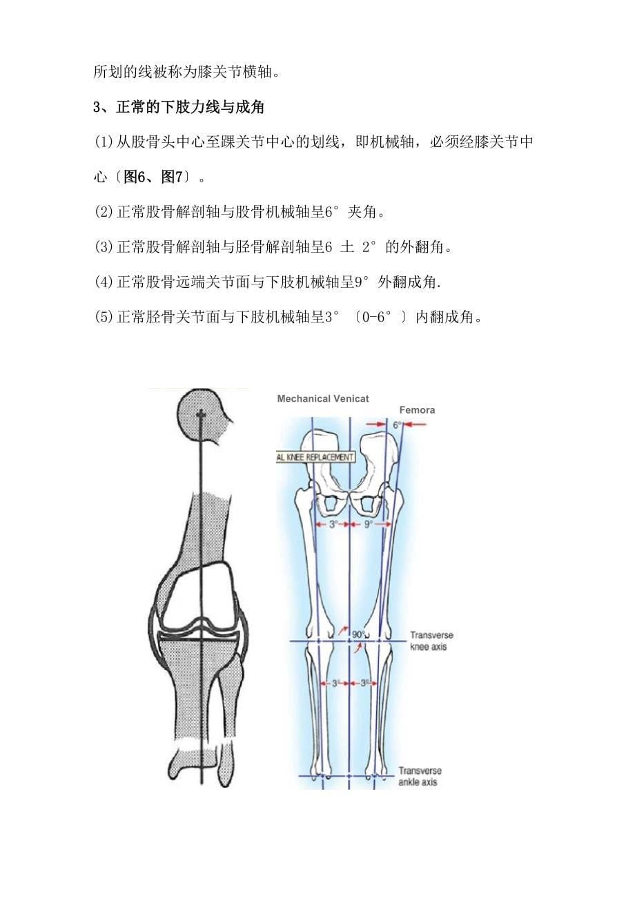 全膝关节置换术的术前准备修改_第5页