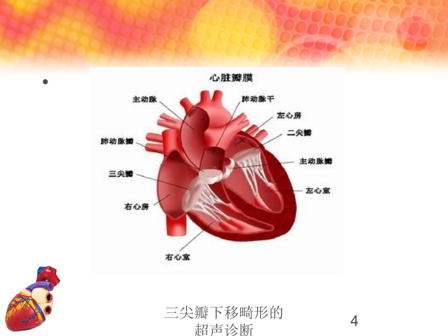 三尖瓣下移畸形的超声诊断培训课件_第4页