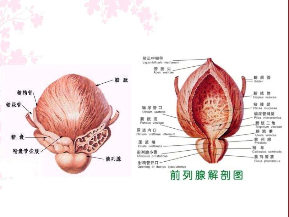 TURP手术麻醉管理ppt课件_第3页