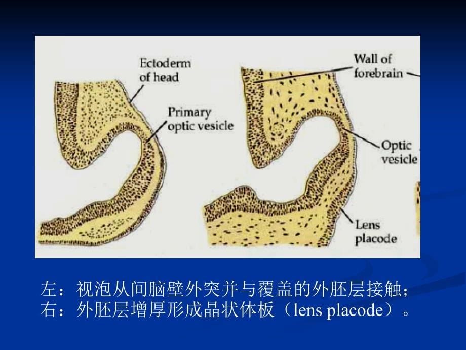 第十四眼的发育_第5页