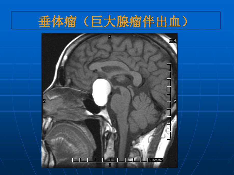 神经病学——大脑小脑脊髓的结构与功能PPT文档_第4页