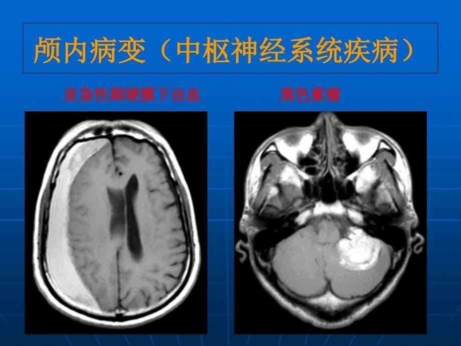 神经病学——大脑小脑脊髓的结构与功能PPT文档_第5页