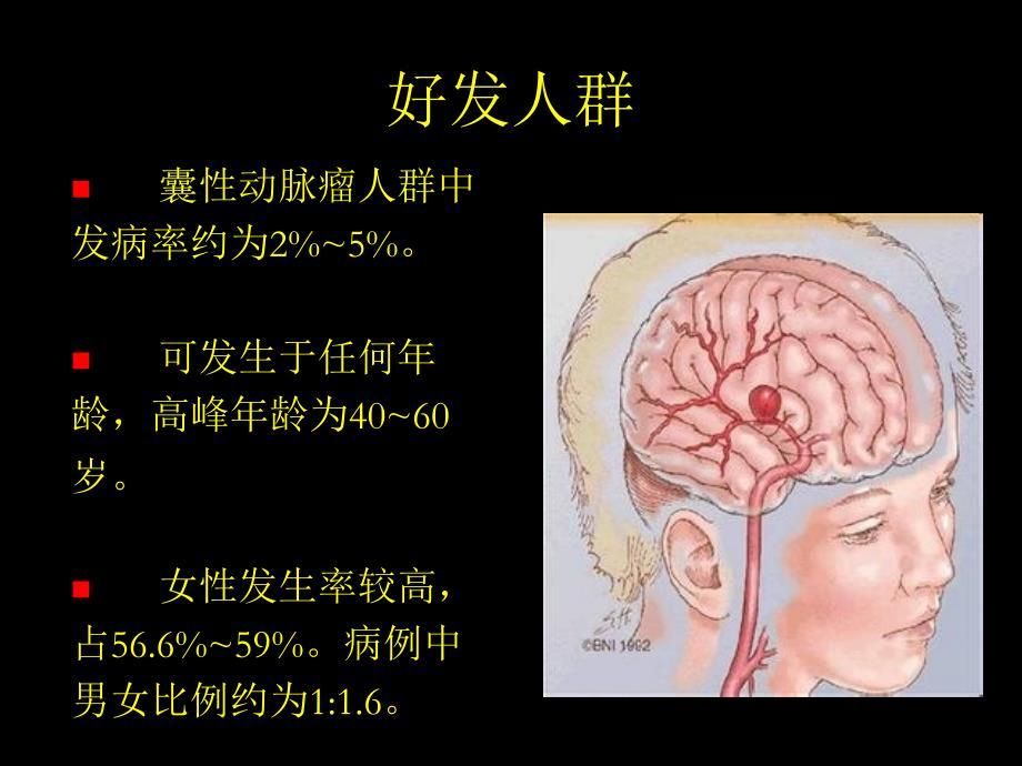 颅内动脉瘤PPT课件_第3页