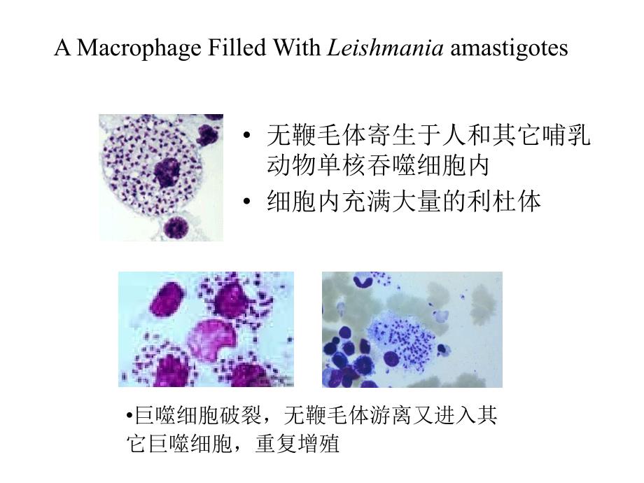 医学微生物学：24-杜氏利什曼原虫_第4页