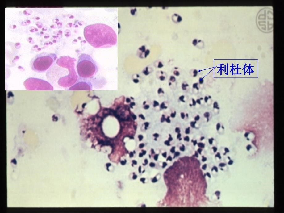 医学微生物学：24-杜氏利什曼原虫_第5页