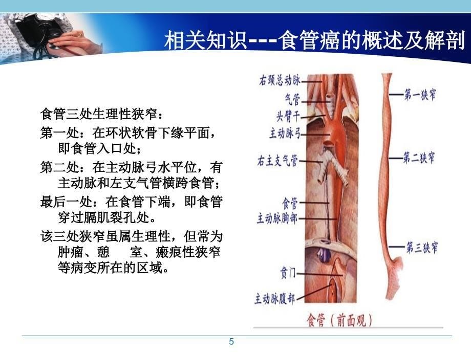 食管癌支架置入护理查房.PPT_第5页