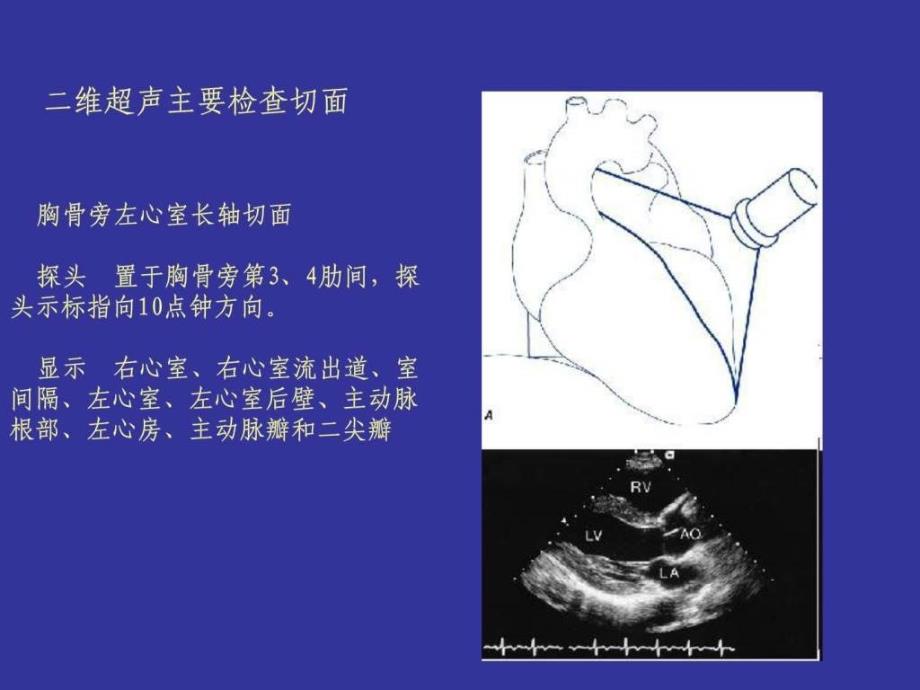 心脏超声图文1671711932.ppt_第4页