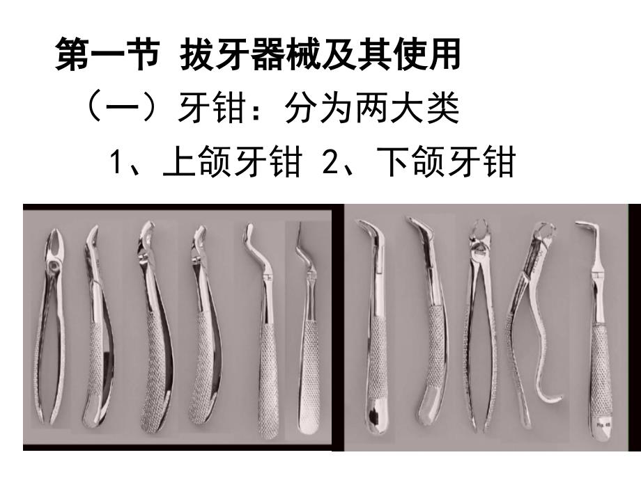 拔牙的过程如何_第1页