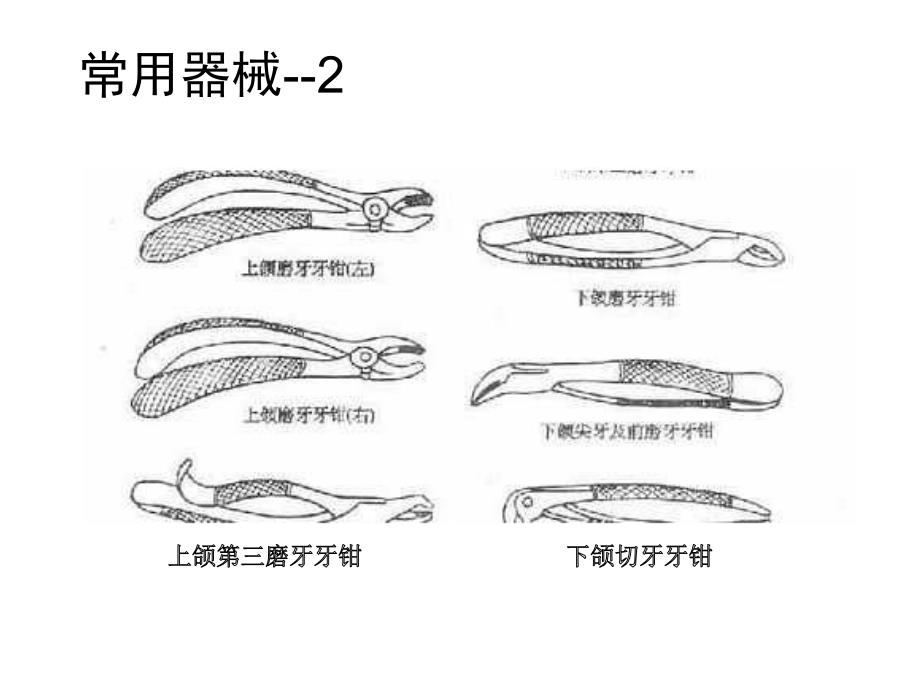 拔牙的过程如何_第4页