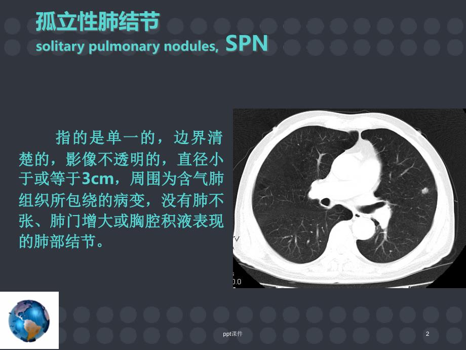 孤立性肺结节的诊断和治疗ppt课件_第2页