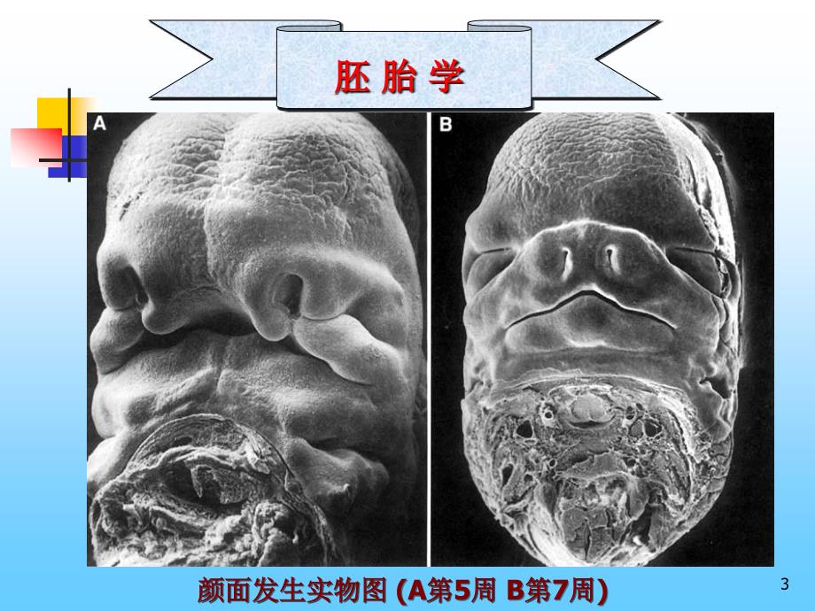 《颜面四肢发生》PPT课件.ppt_第3页