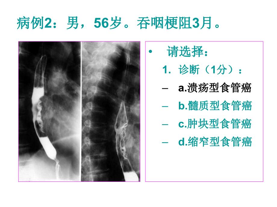 医师资格考试技能-影像试题课件_第3页