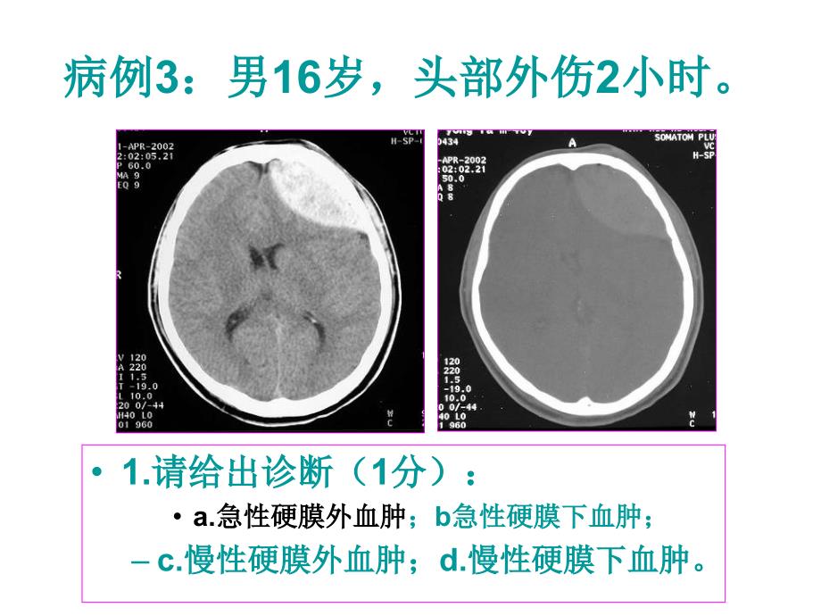 医师资格考试技能-影像试题课件_第4页