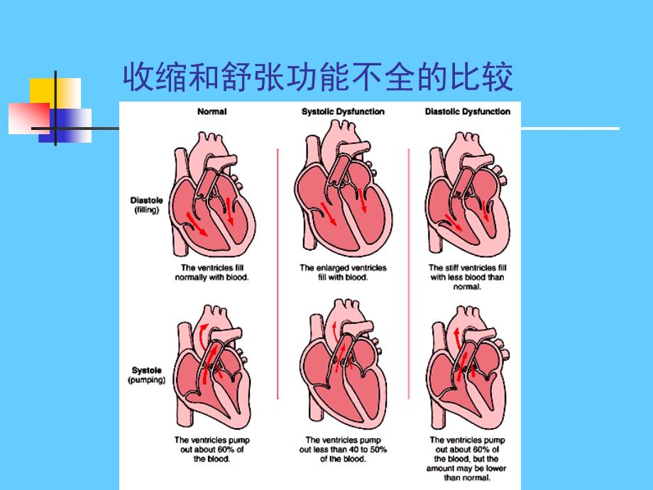 循环系统疾病 心力衰竭_第4页