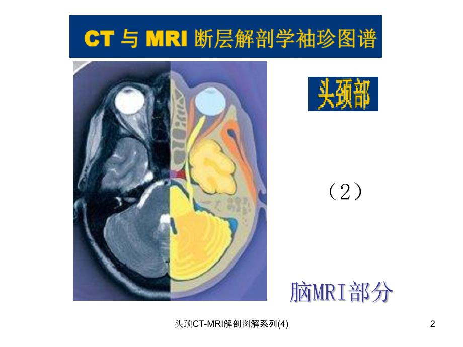 头颈CTMRI解剖图解系列4课件_第2页