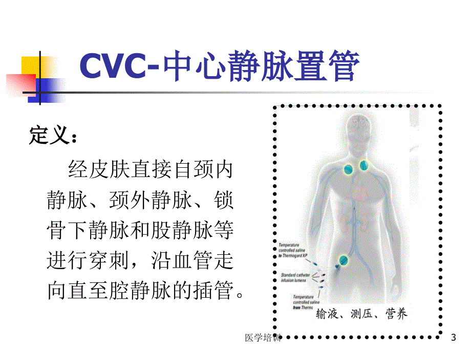 中心静脉置管的相关知识（专业应用）_第3页