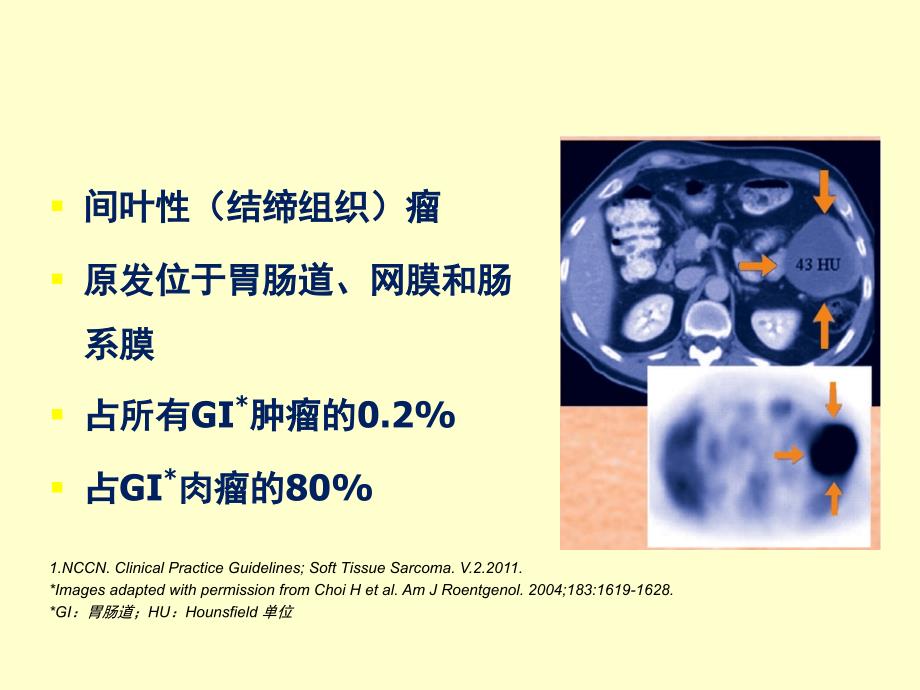 （优质课件）胃肠道间质瘤(GIST)综合治疗经验分享_第3页