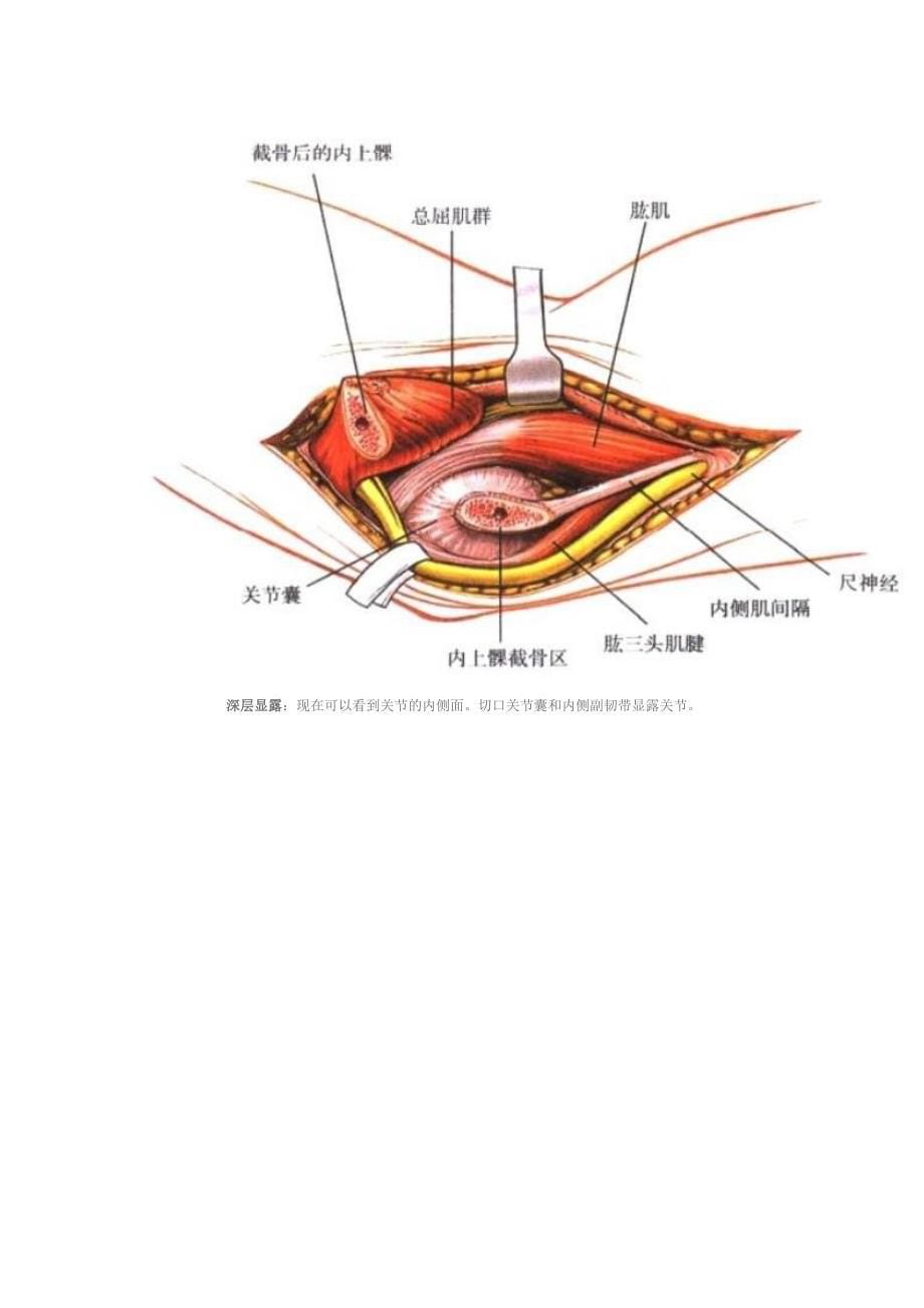 肘关节内侧手术入路_第5页