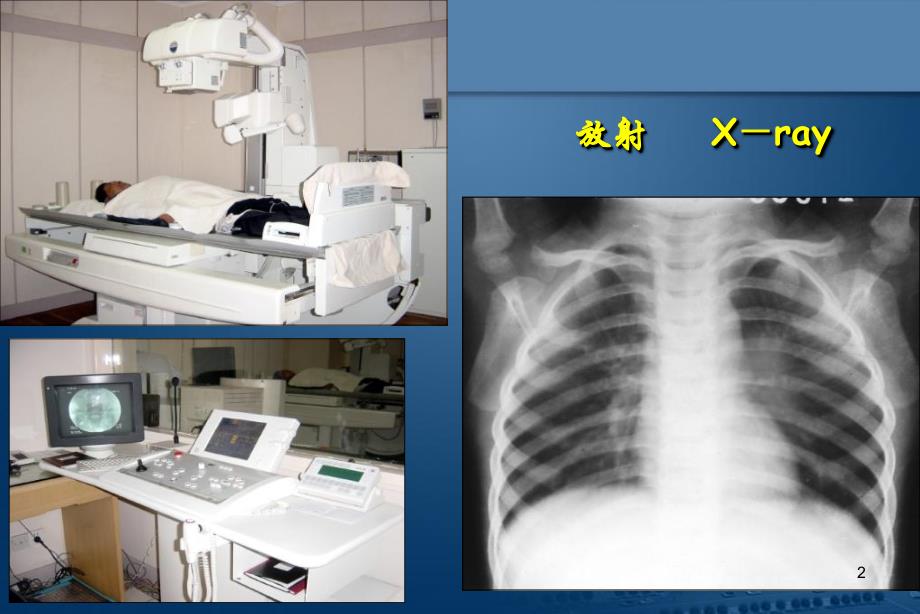 医学影像学总论演示PPT_第2页