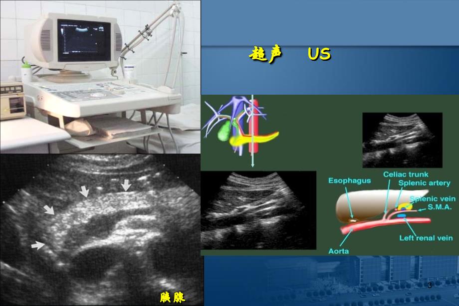 医学影像学总论演示PPT_第3页