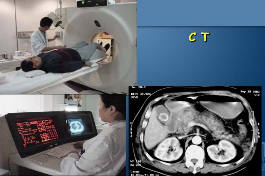 医学影像学总论演示PPT_第4页