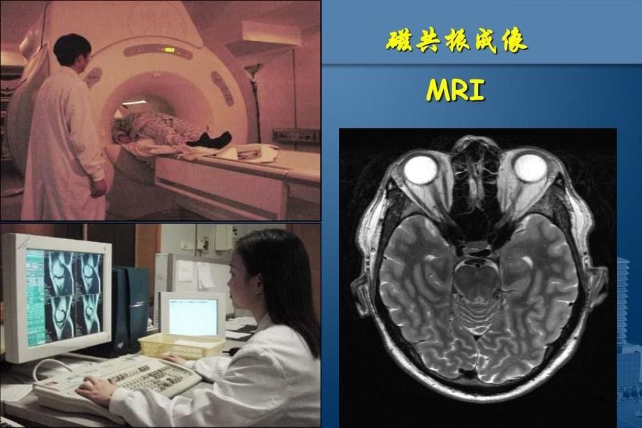 医学影像学总论演示PPT_第5页