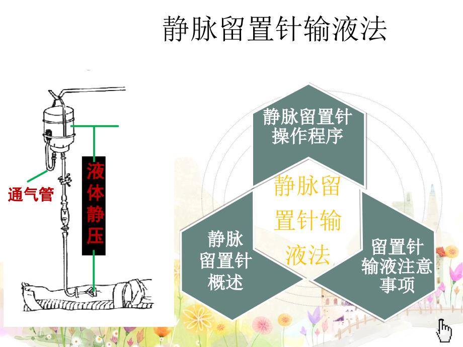 《留置针静脉输液》PPT课件.ppt_第4页