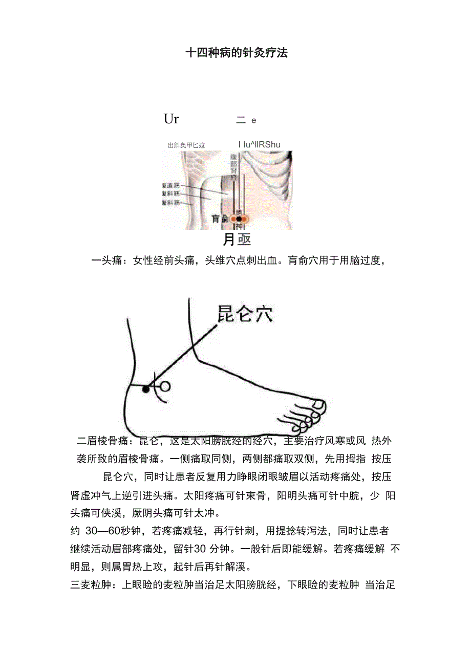 十四种病的针灸疗法_第1页