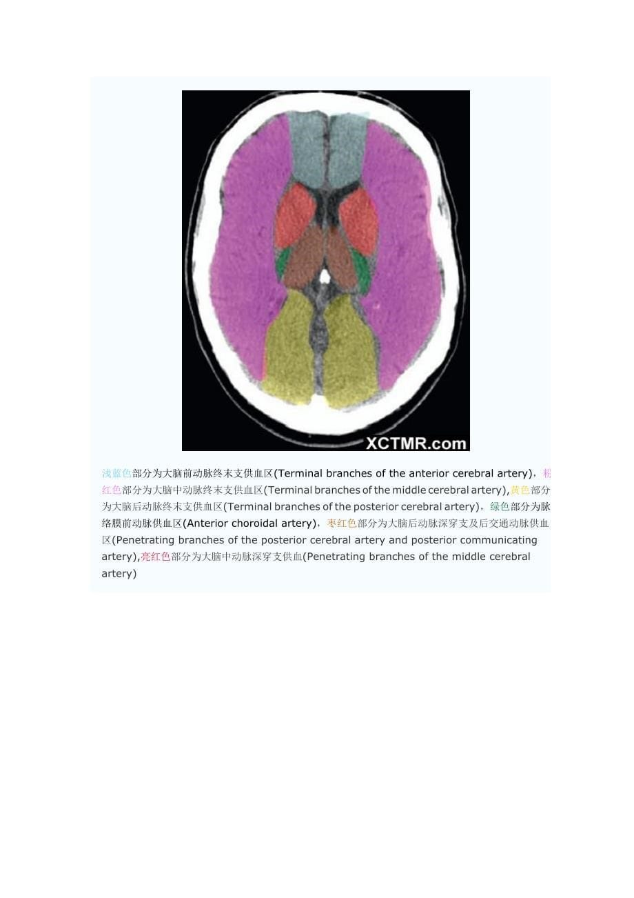 大脑动脉血管供血分区CT解剖图文_第5页