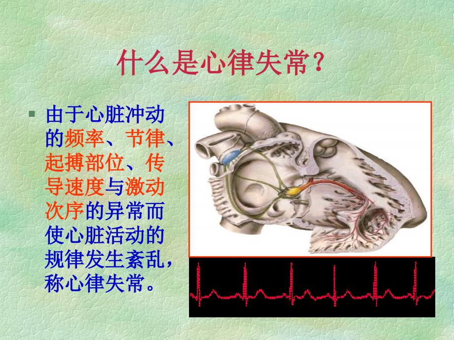 [所有分类]恶性心律失常的识别与护理PPT文档_第4页