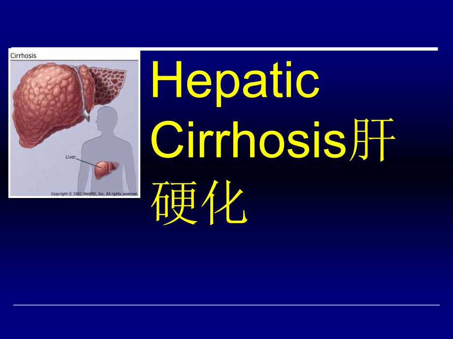 内科学教学课件：Hepatic Cirrhosis肝硬化_第1页