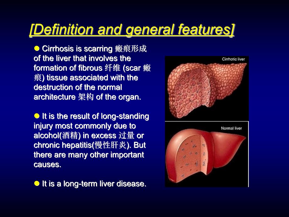 内科学教学课件：Hepatic Cirrhosis肝硬化_第4页