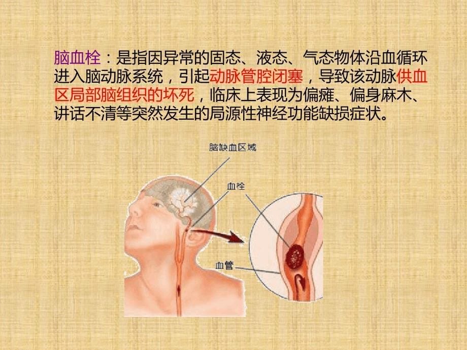 初中七年级生物下册第2单元第2章第4节心脏和血管的保护名师优质课件新版冀教版_第5页