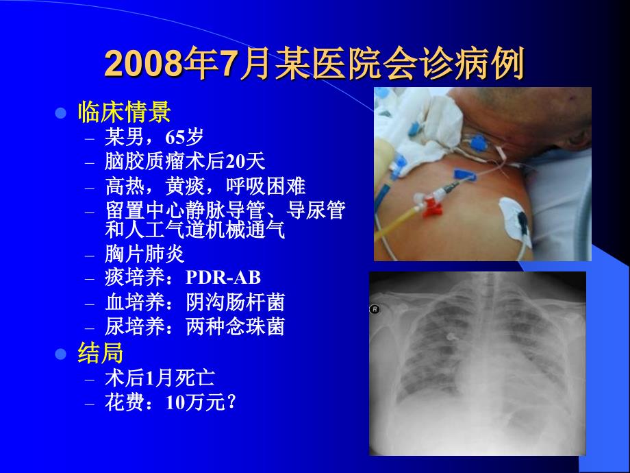 ICU与医院感染预防课件_第4页