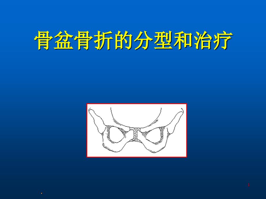 (医学课件)骨盆骨折的分型和治疗ppt演示课件_第1页