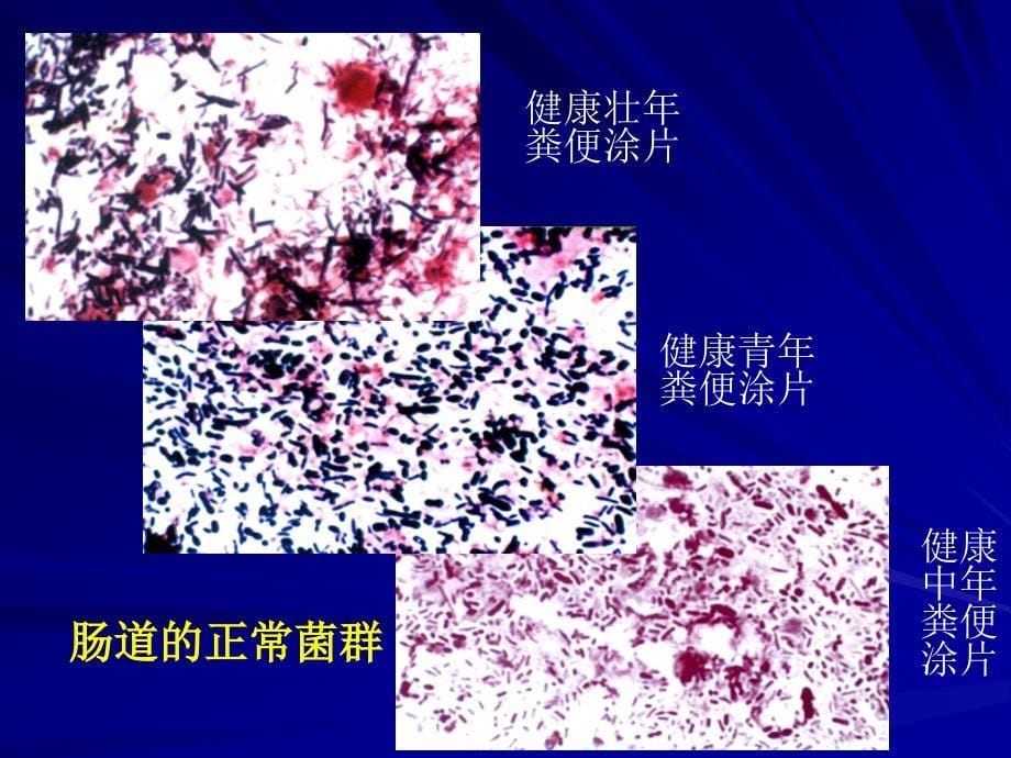 第6章细菌的感染与免疫InfectionandImmunityofBacteria名师编辑PPT课件_第5页